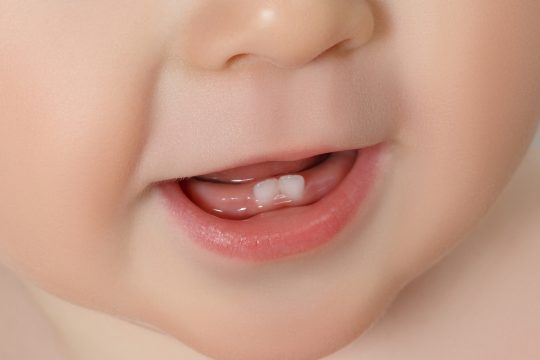 Pentingnya Menjaga Kesehatan Gigi dan Mulut Usia Balita